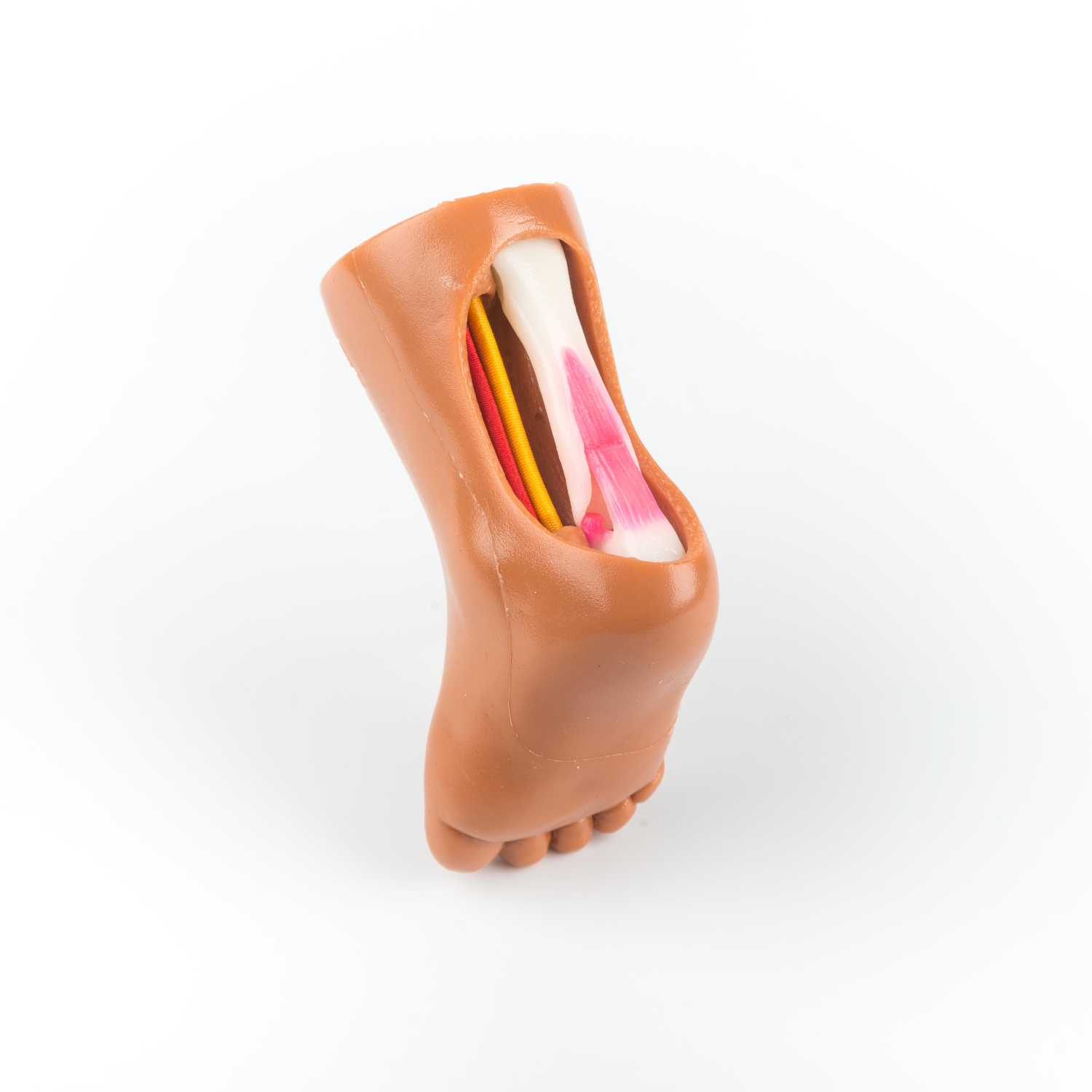 Tenotomy Model – Stepify